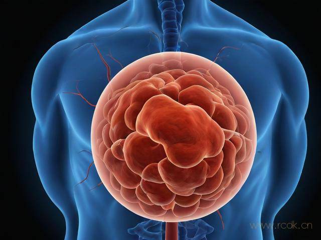 川崎氏病是怎么得的,川崎氏病的治疗方法