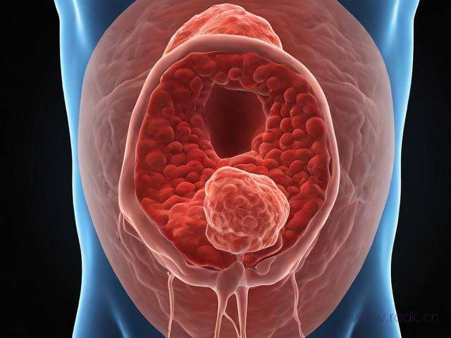 湿疣病怎么引起的,湿疣病是怎么得的