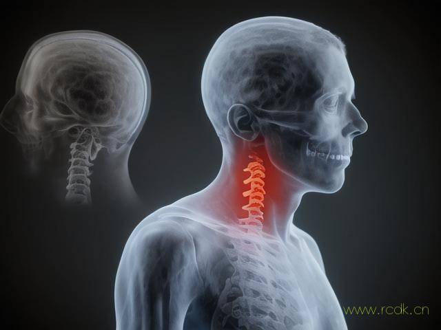 颈椎病增生怎么治最好,颈椎病增生是什么意思