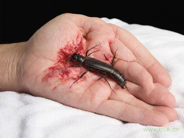 怎么会有阴虱病,怎么会长阴虱的