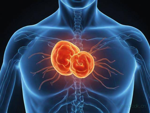 成都结石病医院怎么样,成都结石病医院怎么样收费