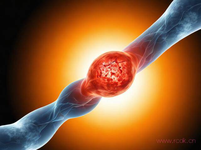 眼底病怎么治,眼底病怎么治疗血管弯曲属于严重吗