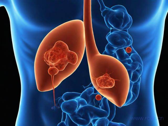 肝包虫病怎么得的,肝包虫病怎么引起的