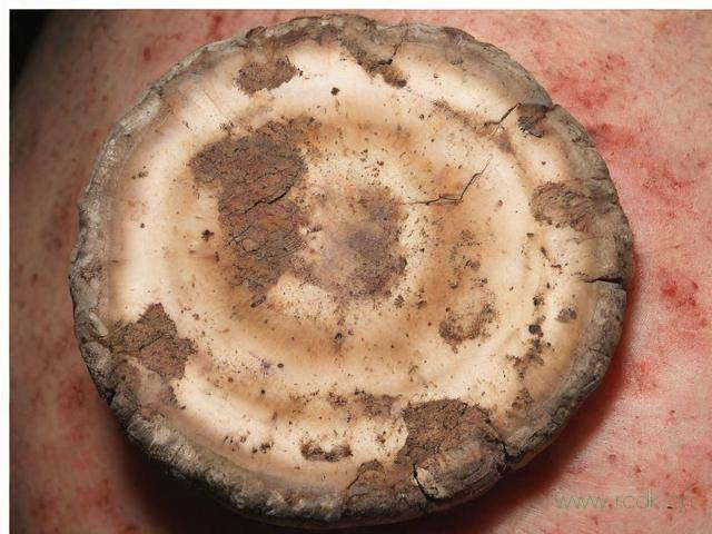 真菌性皮肤病是怎么引起的,真菌性皮肤病是啥