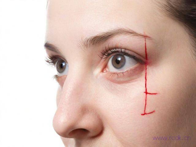 眼红病怎么治疗,眼睛红病